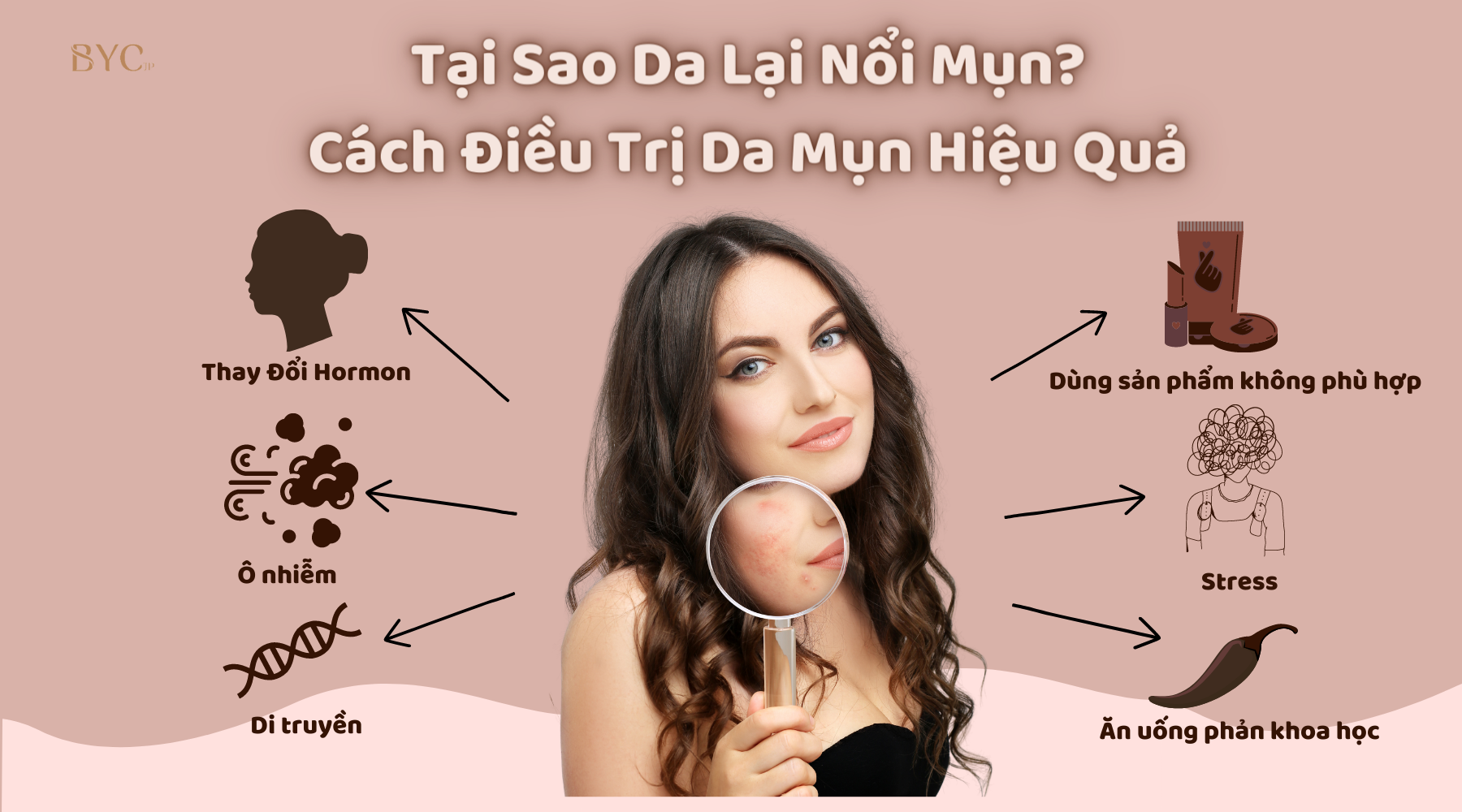 Tại Sao Da Lại Nổi Mụn? Cách Điều Trị Da Mụn Hiệu Quả